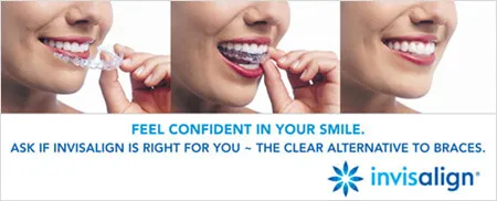 Invisalign - Virtually Invisible Braces